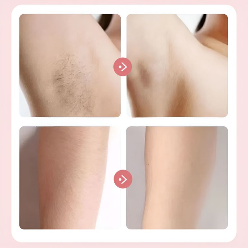 VelvetShave™ | Voor een Zijdezachte en Irritatievrije Huid
